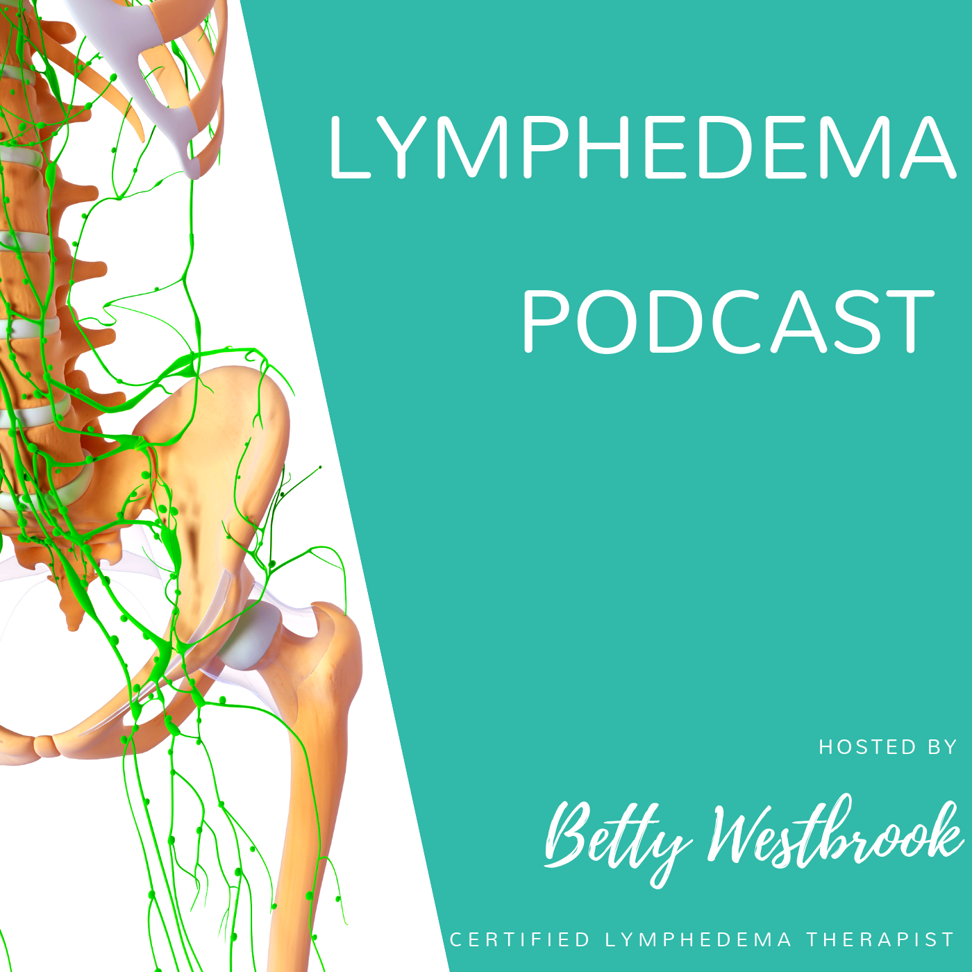 A highlight from Episode 86: Guest host Jean LAMantia, author of The Complete Lymphedema Management and Nutrition Guide.